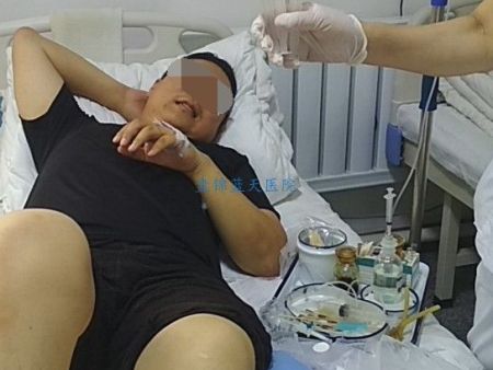 20180725痛风孙先生抽积液