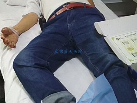 20180711痛风赵先生处置