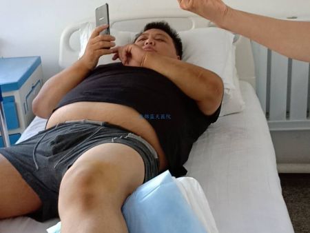 20180816痛风柳先生抽积液