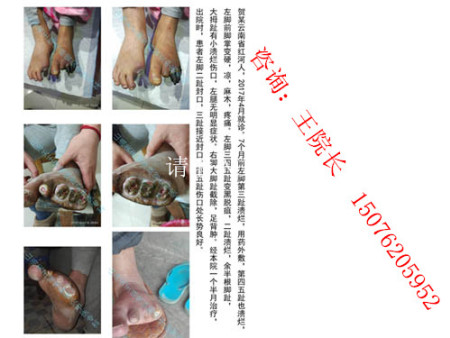 云南贺某前后对比