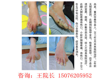 重庆冉某前后对比