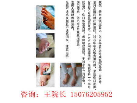 贵州魏某前后对比