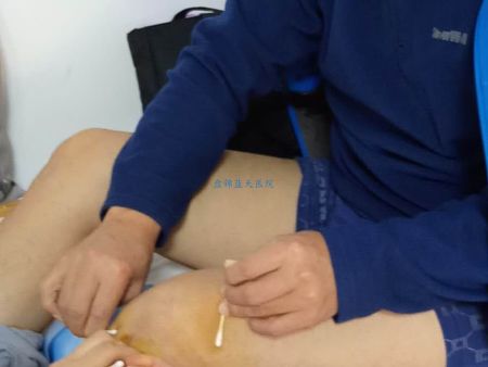 20181020游先生处置