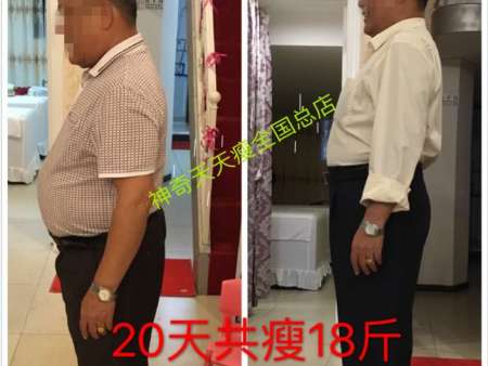 大叔20天共减18斤，30年的肚腩没了！瘦成功后去医院检查，三脂都正常了！