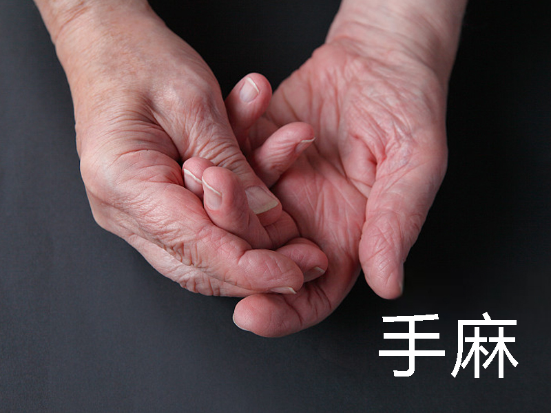 經常手麻的人群