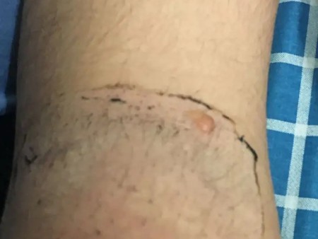 唐山膏药贴制造商 唐山膏药贴制造商