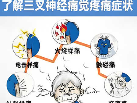 三叉神经痛面肌痉挛治疗中心