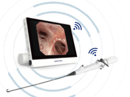 珠海明象无线内镜