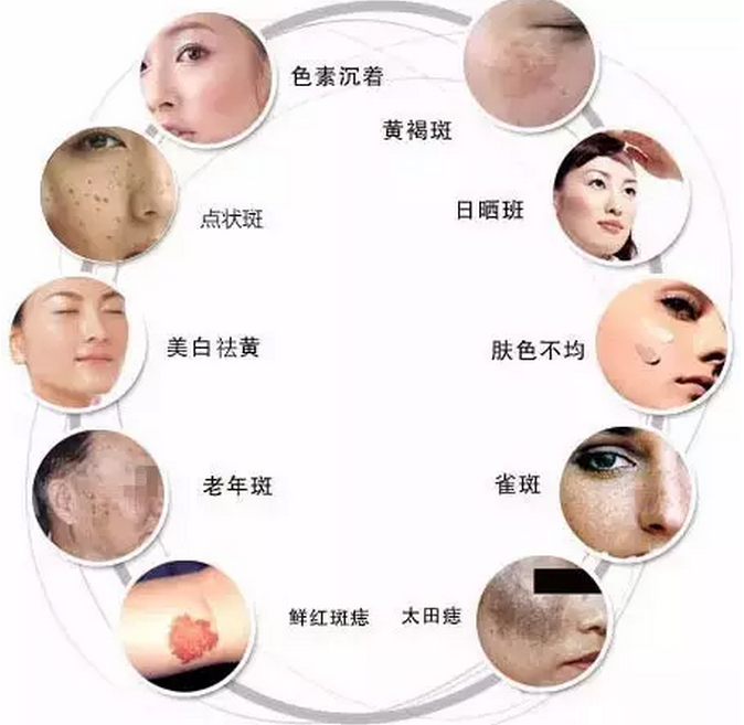 QQ图片20160907143315.png