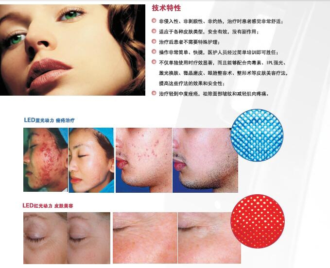 红蓝光治疗仪2.jpg
