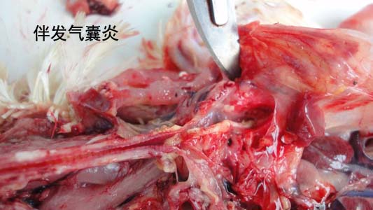 气囊炎.jpg