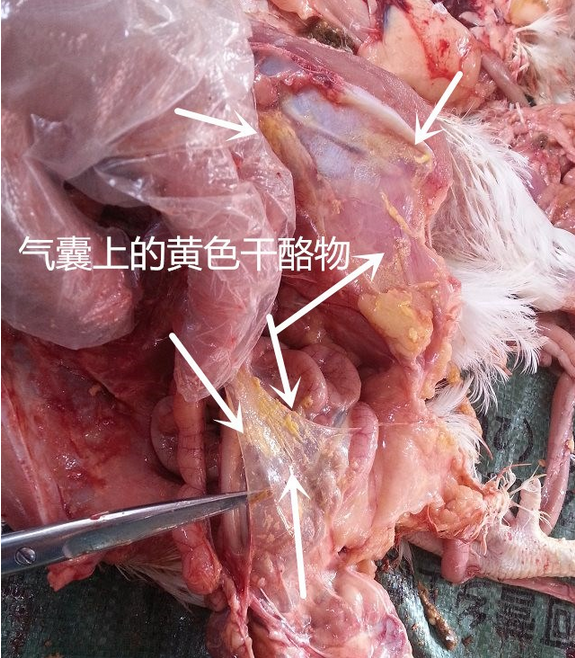 气囊炎2.png