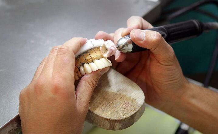 口腔义齿制造