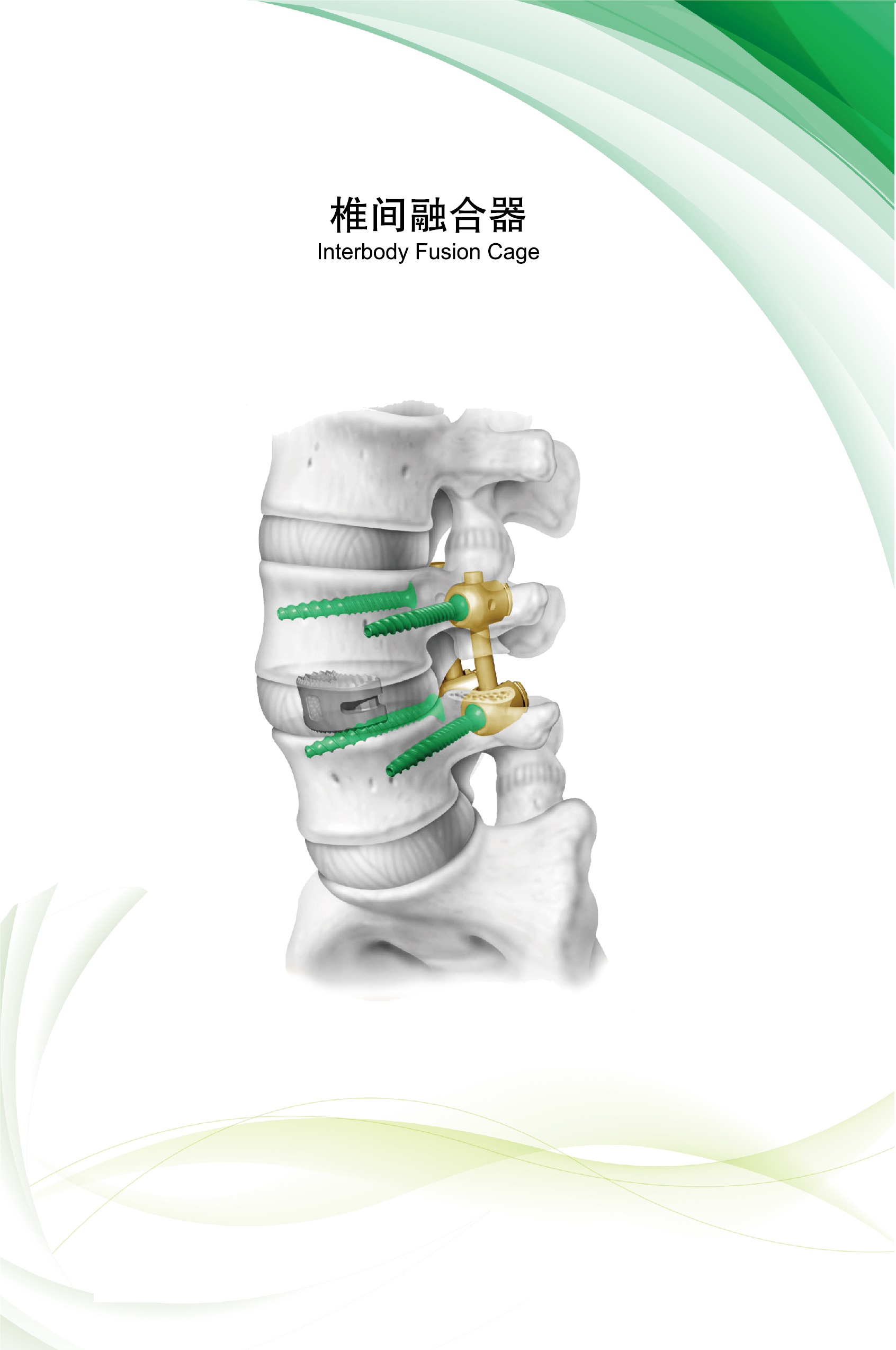 interbody fusion cage