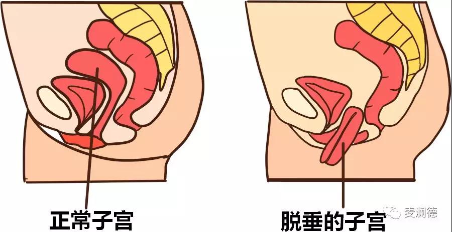 盆底这15条，你可能一条都不知道