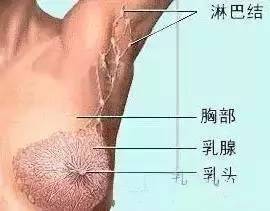 乳腺增生到乳腺癌的四个发展阶段,有几个女人懂得