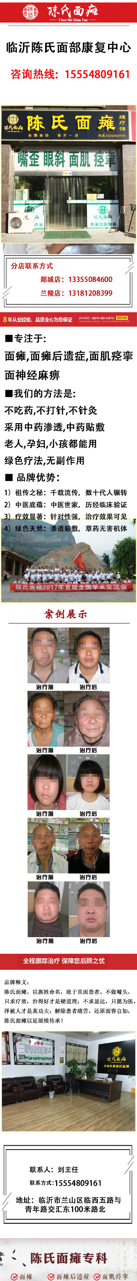 临沂面瘫治疗
