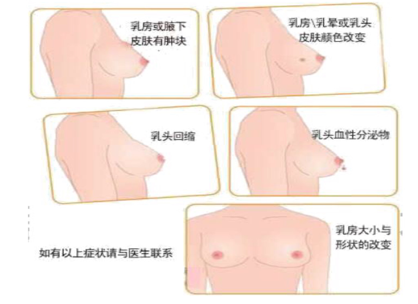 母乳分析