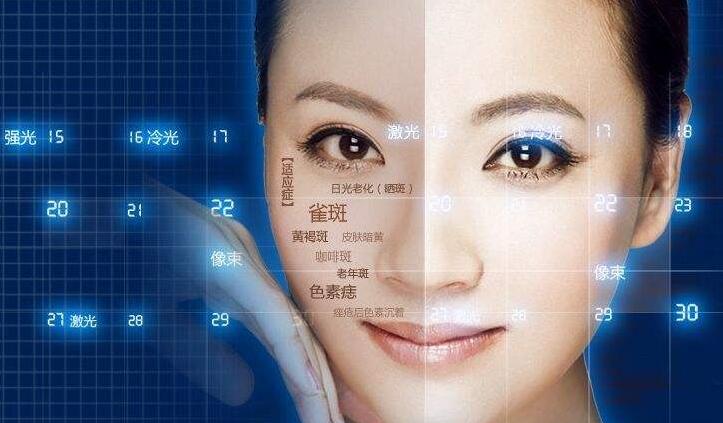 1572608060579094.jpg 面部雀斑