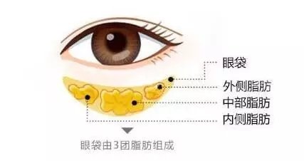 无痕祛眼袋