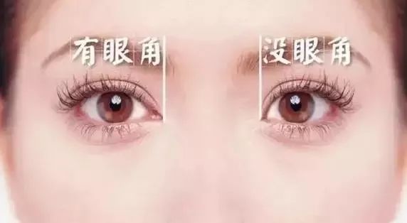 手术开眼角