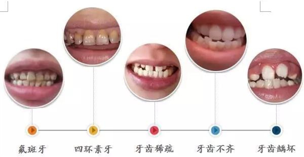 美学修复