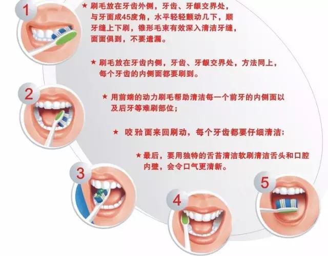正确刷牙要领概括