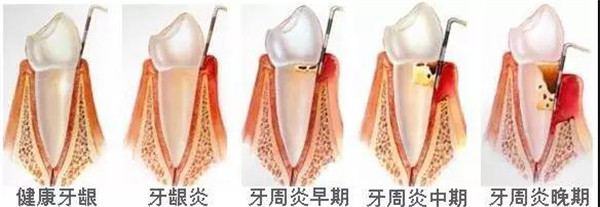 鲅鱼圈看牙