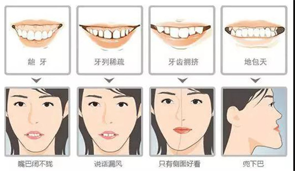 牙齿矫正