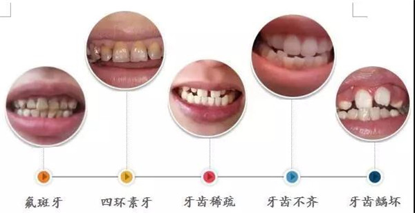 美学修复是什么？