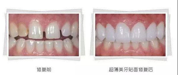 美学修复是什么？