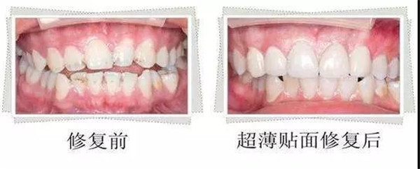 美学修复是什么？