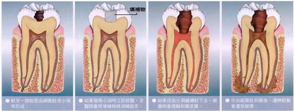 孕期不容忽视的口腔保健知识
