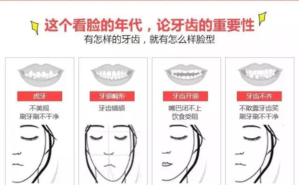 为什么越来越多的人选择牙齿矫正？