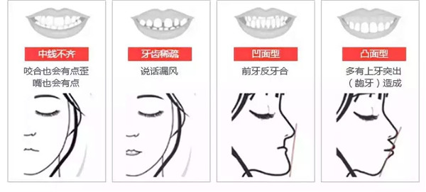 为什么越来越多的人选择牙齿矫正？