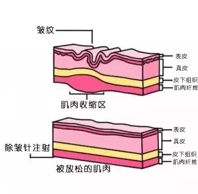 新乡美容 除皱