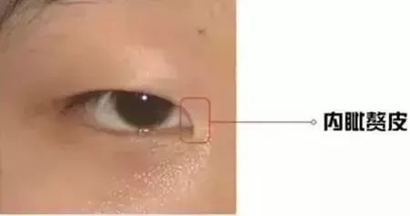 新乡做开眼角电话