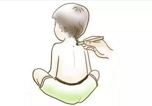 中脘穴
