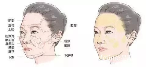 脸颊饱满 新乡美容童颜