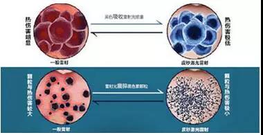 “一秒换肌肤” 蜂巢皮秒让你新年换新颜！
