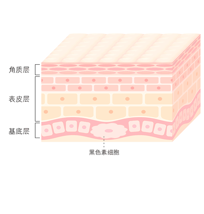 激光去斑症
