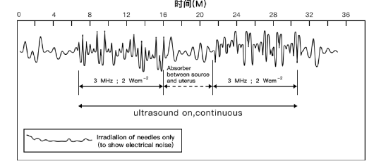 子宫复旧仪器