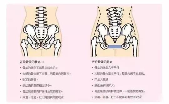 腹直肌修復治療儀器