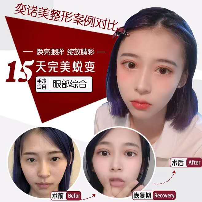 眼综合