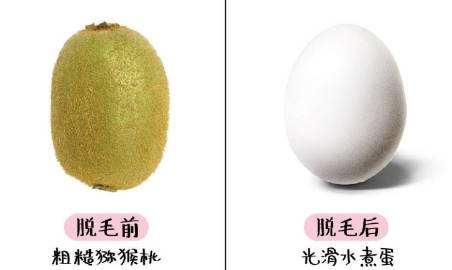 激光脱毛