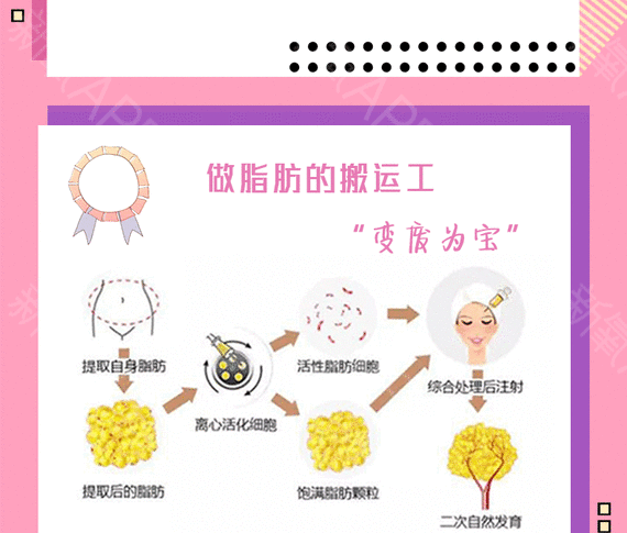 自体脂肪填充