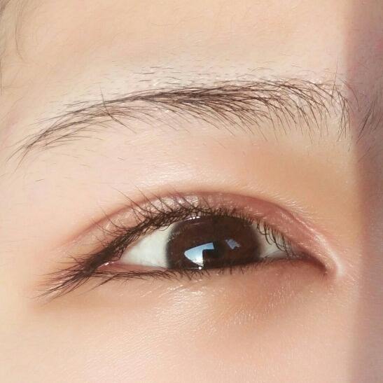 双眼皮