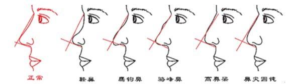 鼻子