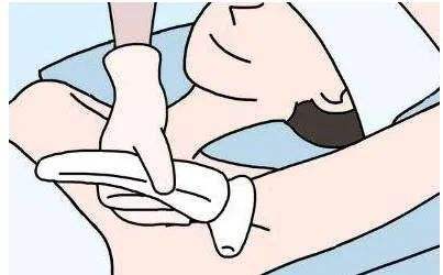 脱腋毛