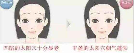丰太阳穴
